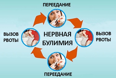 Лечение булимии в Мге